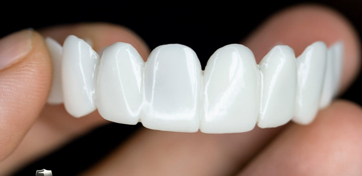 Removable Tooth Veneer for a Confident, Natural-Looking Smile
