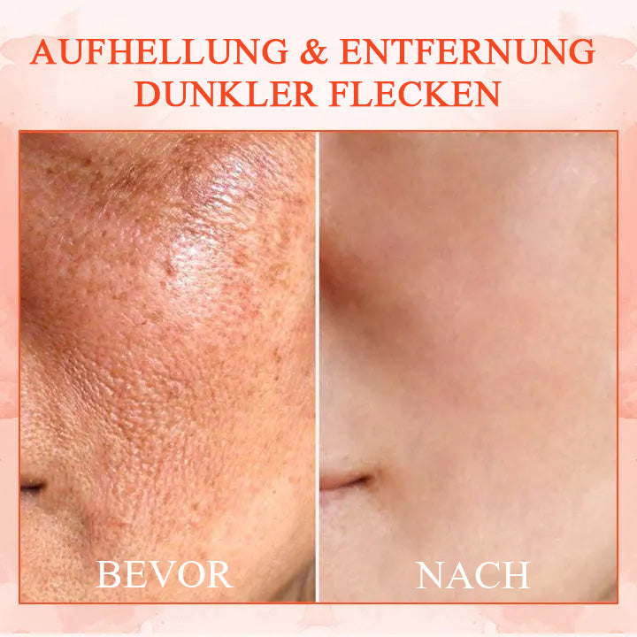 1+1 FREE | LuxeLift™ - Firming and Tightening Body Cream
