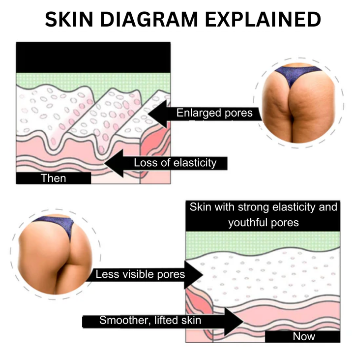 ButtLift™ EMS Trainer for a Firmer Butt