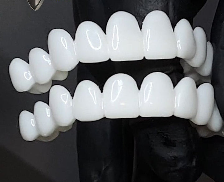 Removable Tooth Veneer for a Confident, Natural-Looking Smile