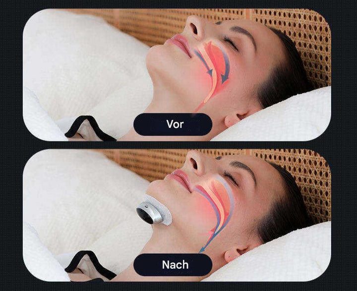 Sleep Apnea Aids