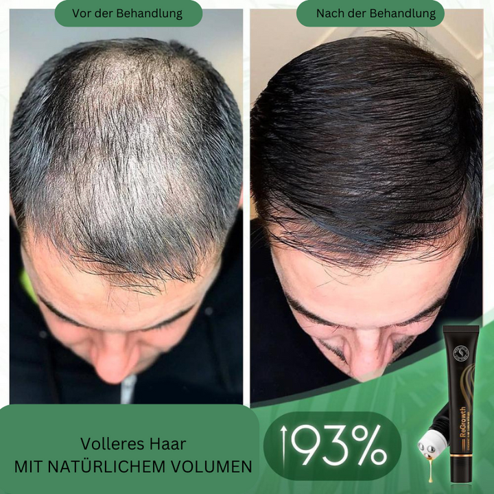 Regrowth™ Bio-Haar-Serum-Roller (1+1 gratis)