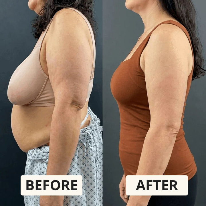 AuraForm™ Shaper Top with Integrated Bra