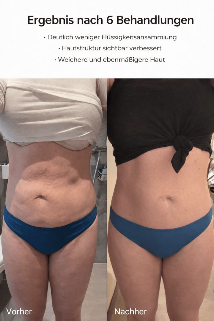 Celluviaa – Smooth Skin in 14 Days