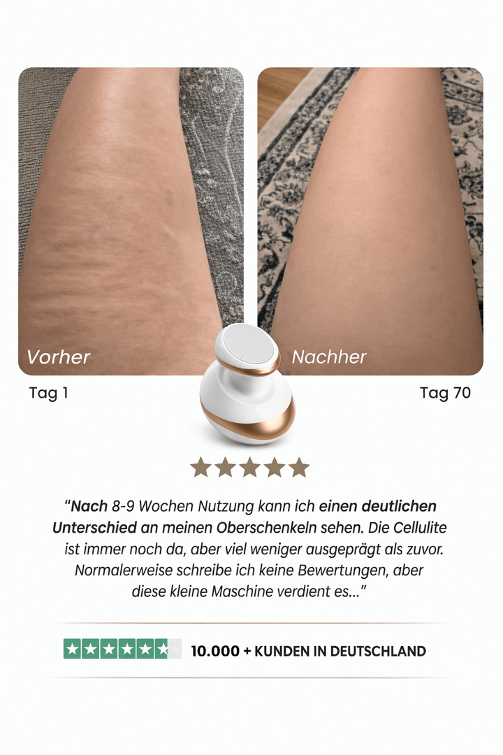 Celluviaa – Smooth Skin in 14 Days