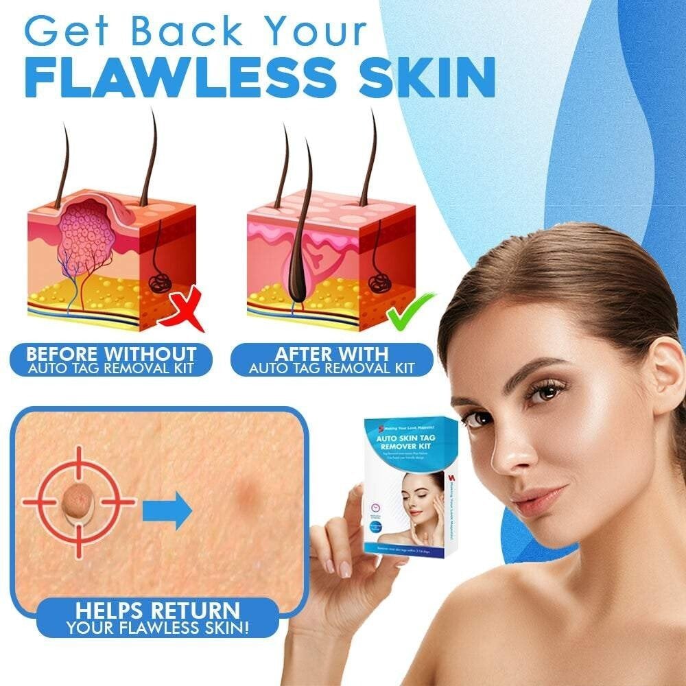 TagGone Automatic Skin Tag Removal Kit | Painless Application | For Smooth, Even Skin