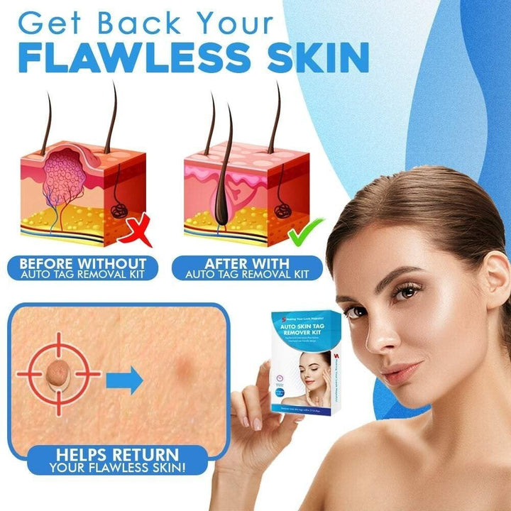 TagGone Automatic Skin Tag Removal Kit | Painless Application | For Smooth, Even Skin