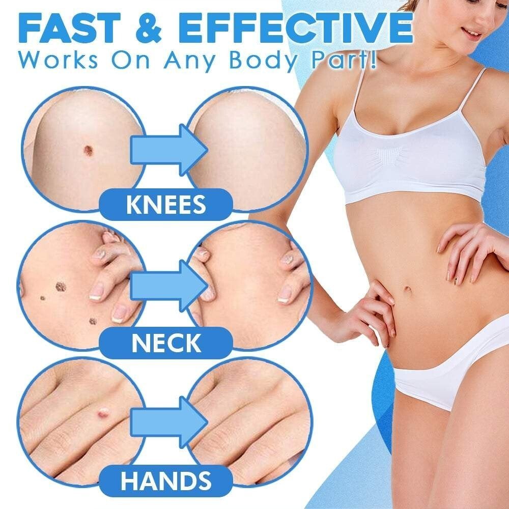 TagGone Automatic Skin Tag Removal Kit | Painless Application | For Smooth, Even Skin