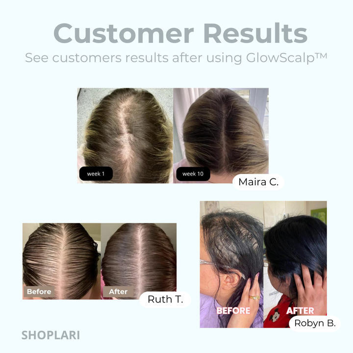 GlowScalp™ Scalp Massaging Brush
