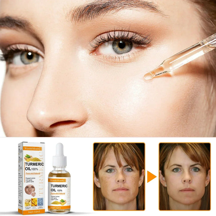 1+1 FREE Golden Glow Reduces Dark Spots, view 3 - Elena Harper